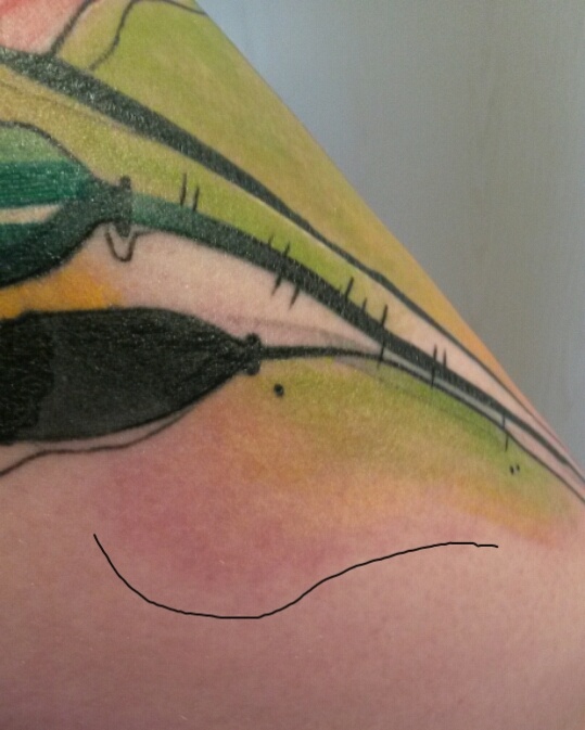 Poppy124: nach 4/5 Wochen: seltsame "Rötung" ?!?